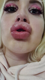 Vivianroseofficial 02 01 2021 2000073935 Pics from my last lip filler session Cant wait to 