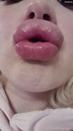 Vivianroseofficial 02 01 2021 2000073940 Pics from my last lip filler session Cant wait to 